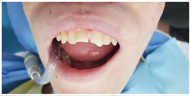 Before-Dental-3